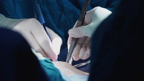 The hands of a surgeon Stock Footage 127702964