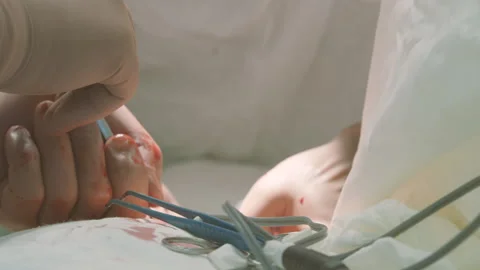 Hands of surgeons 2 Stock Footage 141437842