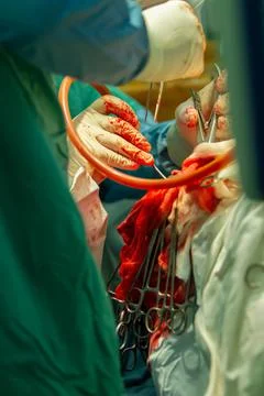 Hands of surgeons during surgery Stock Photos