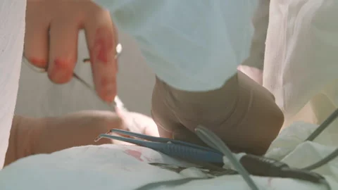 Hands of surgeons Stock Footage 141438033