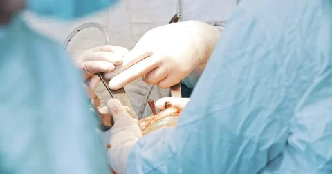 Hands of a team of neurosurgeons Stock Footage 50688371