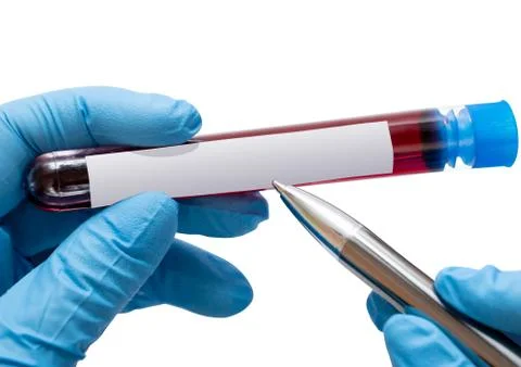 In the hands of the test tubes with blood ready for testing. Blood for analys Stock Illustration