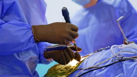 Hands of the unrecognized surgeons in brown latex gloves. Doctors hold surgical Stock Footage 333337006