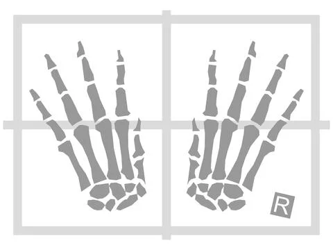 Hands x-ray illustration Stock Illustration