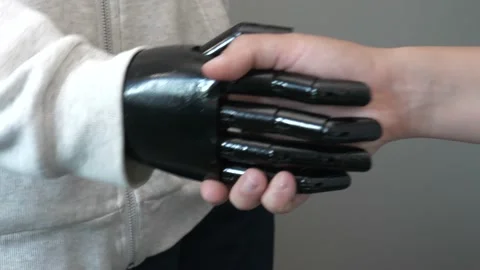 Handshake With an Artificial Prosthetic Hand Stock Footage 135699180