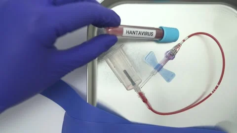 Hantavirus blood sample collected during venipuncture procedure Stockbeeldmateriaal 334840397