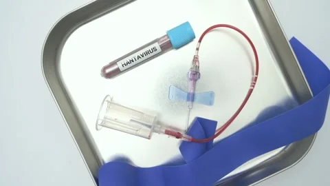 Hantavirus blood sample collection procedure for testing Stock Footage 334840237