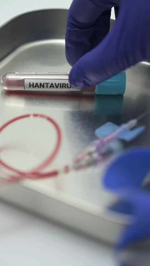 Hantavirus blood sample test in a laboratory Stockbeeldmateriaal 334840312