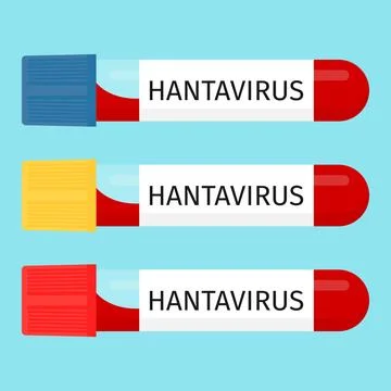 Hantavirus blood sample tubes vector set Stock-Illustration