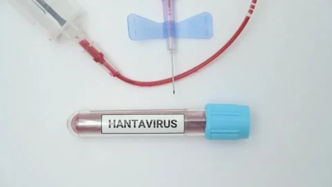 Hantavirus blood test sample collection process Stock Footage 334840393