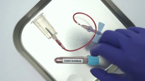 Hantavirus blood test sample on a surgical tray Stockbeeldmateriaal 334840405