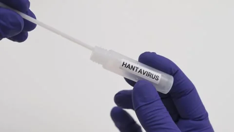 Hantavirus lab testing with a nasal swab and vial Stockbeeldmateriaal 334602597