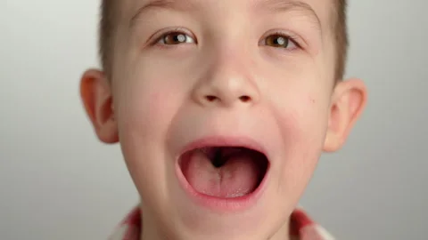 Happy Boy Showing His Missing Baby Teeth and Growing Permanent Teeth Stock Footage 280179187