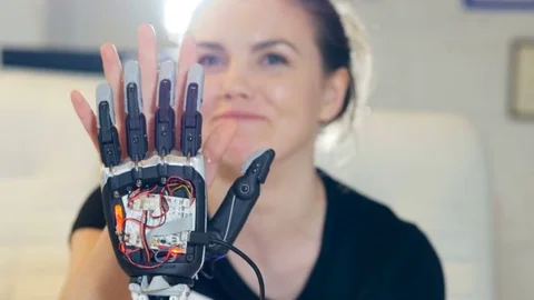 Happy disabled lady touching the robot hand with her healthy palm. Close-up Stock Footage 74994770