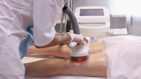 Hardware anti-cellulite massage. RF lifting procedure. Stockbeeldmateriaal 155754611