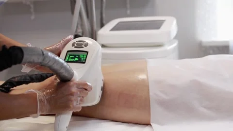 Hardware anti-cellulite massage. RF lifting procedure. Ultrasound cavitation. Video stock 155984880