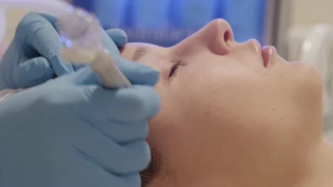 Hardware face pores cleansing, close-up. Stock Footage 202785653