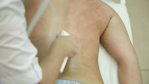 Hardware massage of female back Stock Footage 83727069