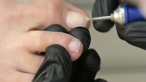 Hardware medical pedicure with a drilling machine Stock Footage 208064688