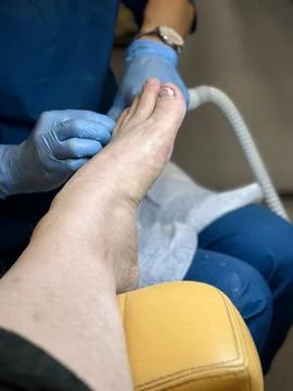 Hardware medical pedicure using a drill and nail files. A patient has a pedicure Foto stock