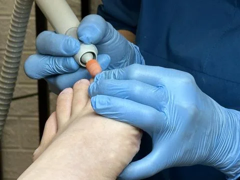 Hardware medical pedicure using a drill and nail files. A patient has a pedicure Foto stock
