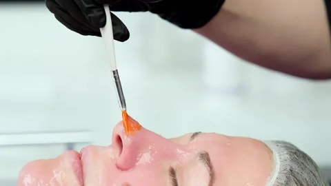 Hardware procedure in cosmetology. Stockbeeldmateriaal 263973483