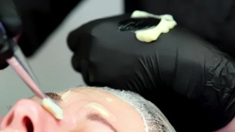 Hardware procedure in cosmetology. Stockbeeldmateriaal 263974424