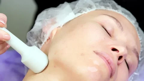 Hardware procedure in cosmetology. Stockbeeldmateriaal 263978652