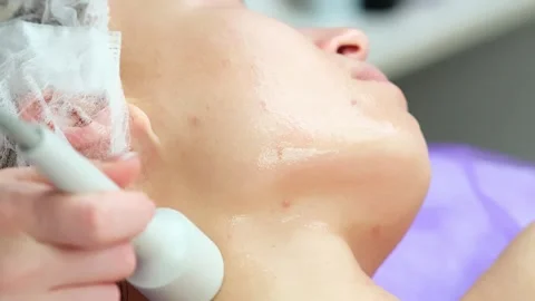 Hardware procedure in cosmetology. Stockbeeldmateriaal 263978787