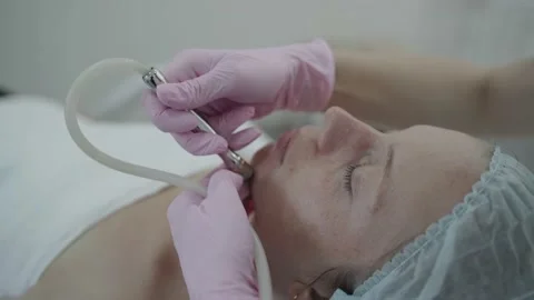 Hardware procedures in the cosmetologist's office Stock Footage 166170039