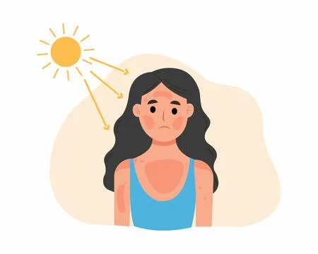 Harmful UV ray from sun made the redness appear Stock Illustration