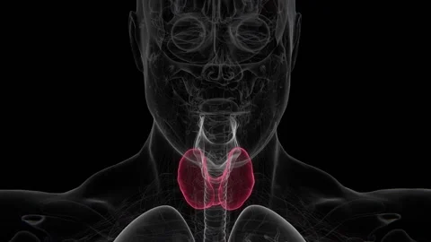 Hashimoto's thyroiditis is an autoimmune disorder in which the immune system Stock Footage 345125613