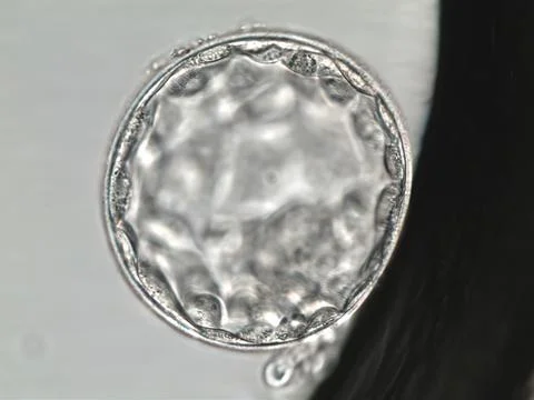 Hatched human blastocyst. Grade AA. Fifth day of development. Stock Photos