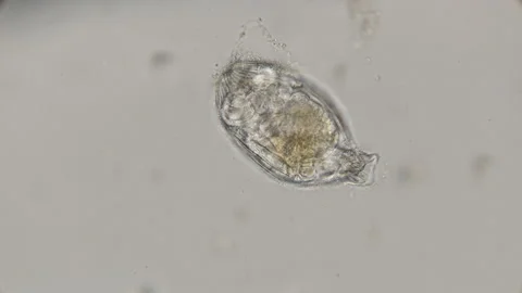Hatching from the egg of a creeping Rotatoria under a microscope Stock Footage 92053816