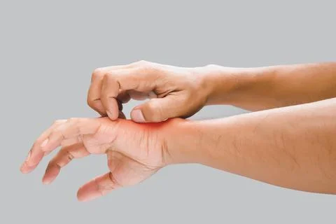 Have a itching Stock Photos