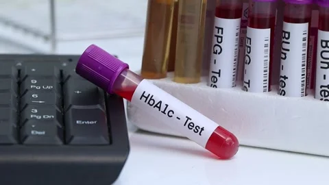 HbA1c test from blood  Stock Footage 224279401