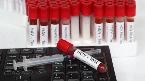 HCV Test to look for abnormalities from ... | Stock Video | Pond5