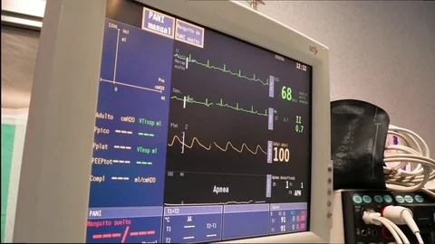 HD. Anesthesia cart of an operating room Stock Footage 75786059