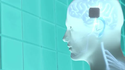 Head 01 brain chip implan 3d render Stock Footage 170011555