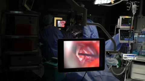 Head And Brain Surgery being performed Stock Footage 239604244