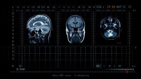 Head and brain X-rays. Medical check-up background for hospital health and Video stock 336579643