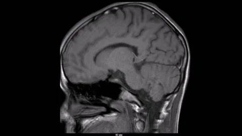 Head clinical libraries MR SR MRI tomography Vídeo Stock 196876682