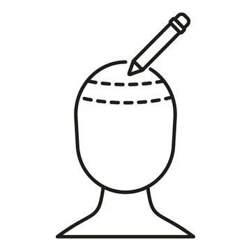 Head with dashed lines indicating hair transplant area Stock Illustration