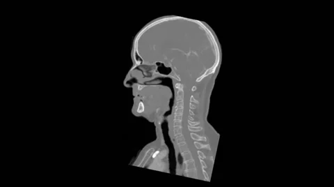 Head, Enhanced CT Scan Stock-Footage 64800419
