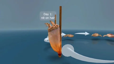 Head lice life cycle 3D Stock Footage 301445209