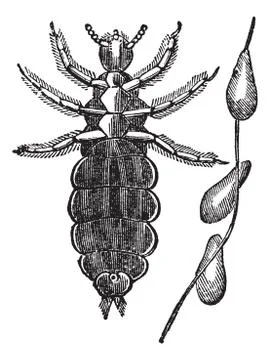 Head lice or Pediculus humanus capitis vintage engraving Stock Illustration