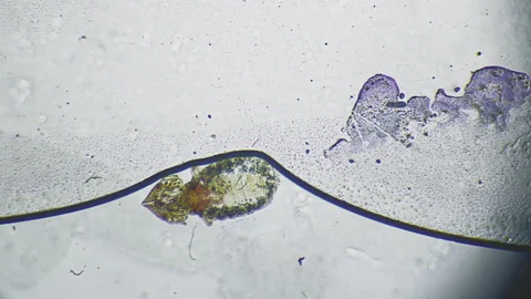 Head lice under the microscope. Skin flea under magnification. The insect in the Stock Footage 160357020