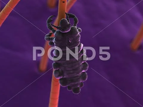 Head louse, artwork Stock Illustration