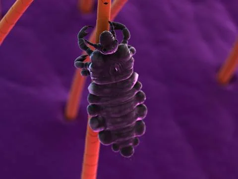 Head louse, artwork Stockillustratie