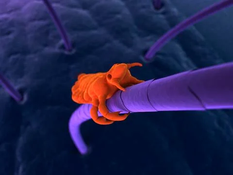 Head louse, artwork Stockillustratie